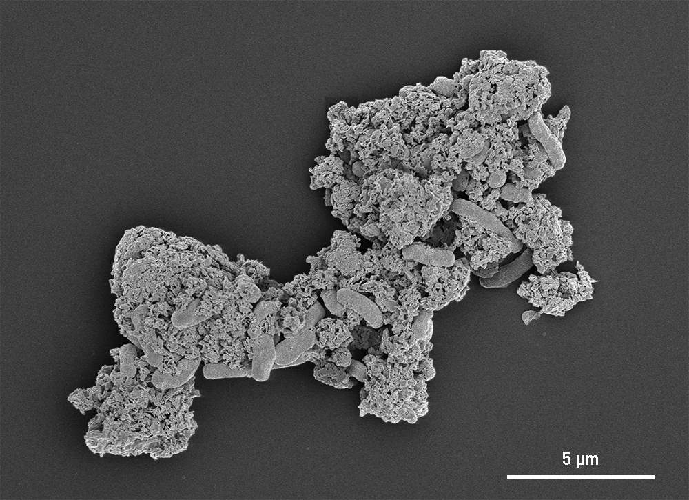 SCANNING ELECTRON MICROSCOPE IMAGE OF E. COLI SURROUNDED BY POLYETHYLENIMINE AND CARBON NITRIDE