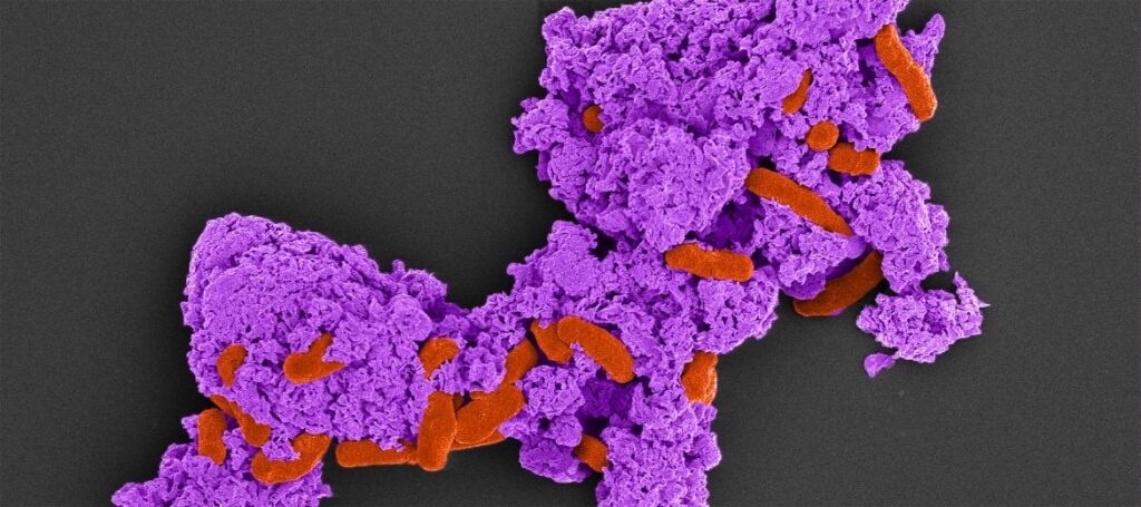 COLOUR ENHANCED SCANNING ELECTRON MICROSCOPE IMAGE OF E. COLI (ORANGE) SURROUNDED BY POLYETHYLENIMINE AND CARBON NITRIDE (PURPLE)