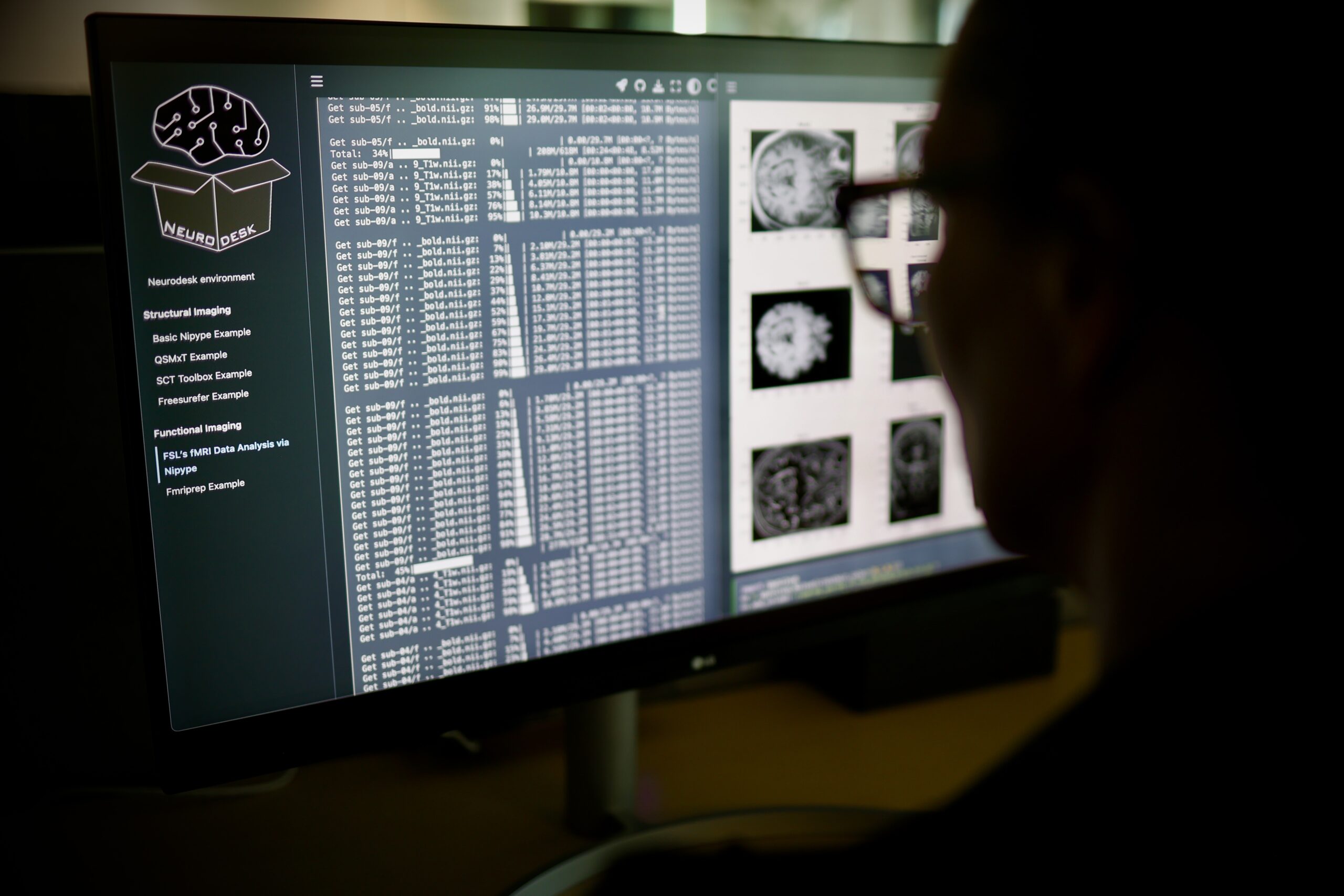 Case study_NIF_Brain research supercharged by new ‘control panel’ accessible worldwide